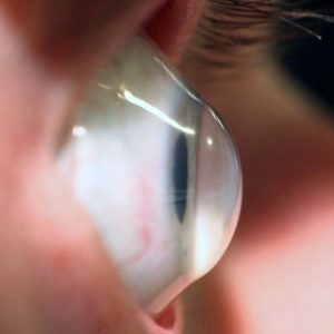 Novos Serviços na Área da Oftalmologia Novos Serviços na Área da Oftalmologia