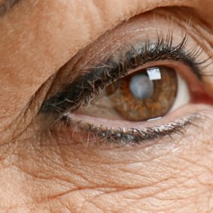 O que deve saber sobre a operação às cataratas