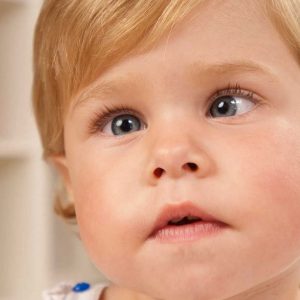 Estrabismo: Um olhar criterioso sobre os sintomas, causas e tratamentos