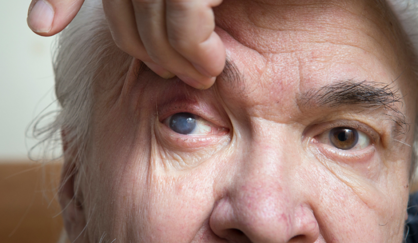 Glaucoma – Descubra como o diagnóstico precoce pode prevenir a perda de visão