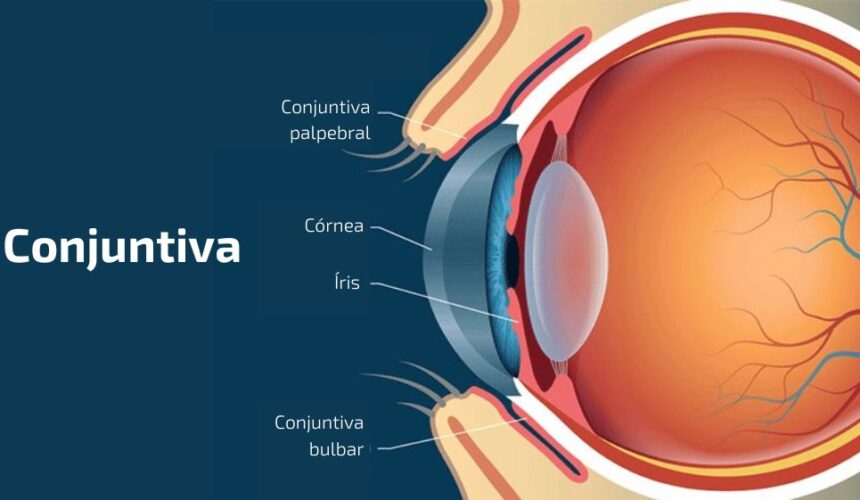 Conjuntiva: o que é, função, principais doenças e irritações Conjuntiva: o que é, função, principais doenças e irritações