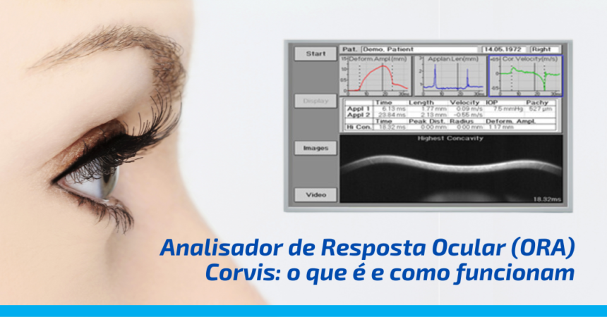 Analisador de Resposta Ocular (ORA) – Corvis: o que é e como funcionam