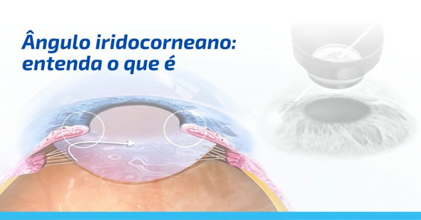 Ângulo iridocorneano: entenda o que é