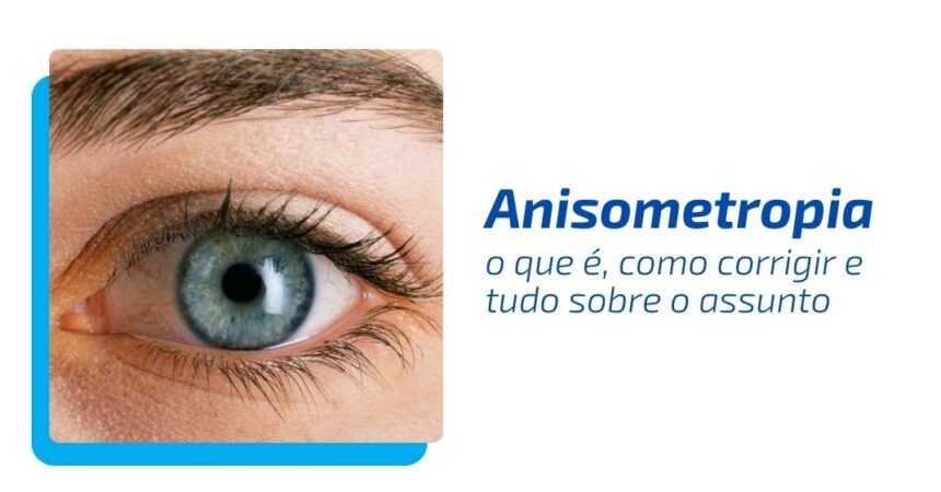 Anisometropia: o que é, como corrigir e tudo sobre o assunto